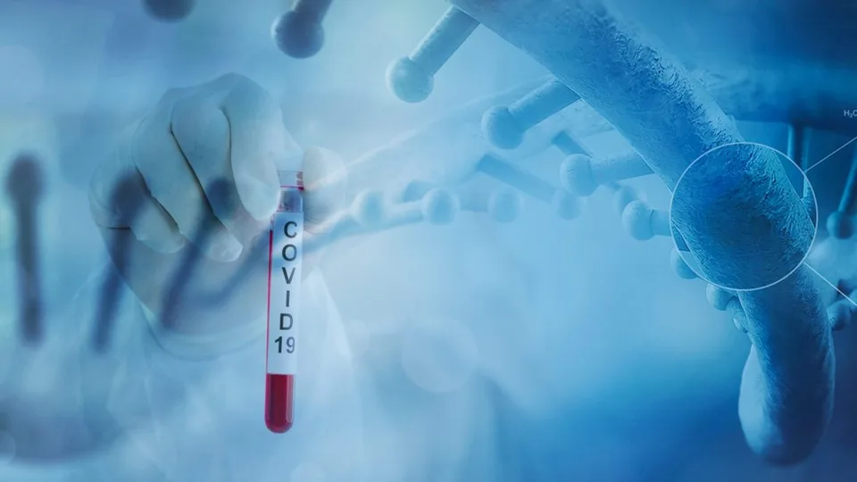 Read more about the article Na Slovensku pribudlo 531 pozitívne testovaných na COVID-19
