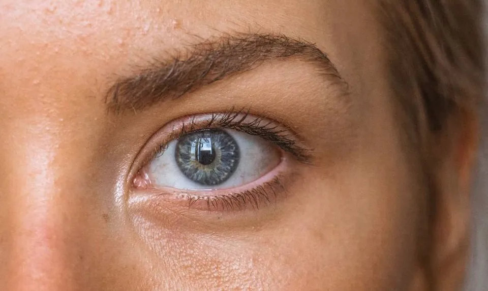 Read more about the article Z očného jačmeňa sa môže stať chronický problém: Ako mu predísť?