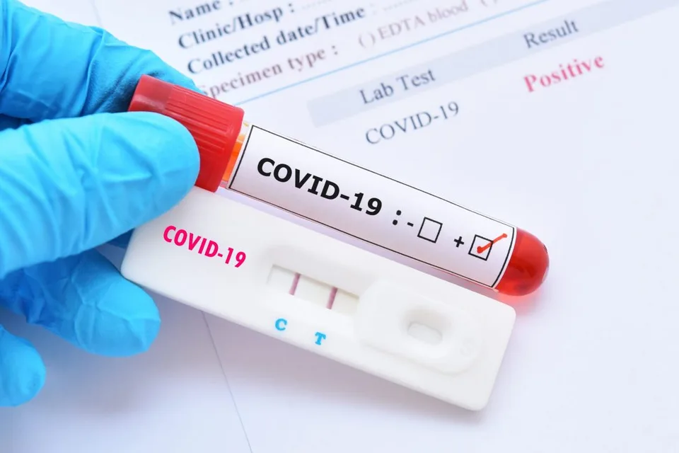 Read more about the article Covid na Slovensku: Testovanie odhalilo nové prípady nákazy