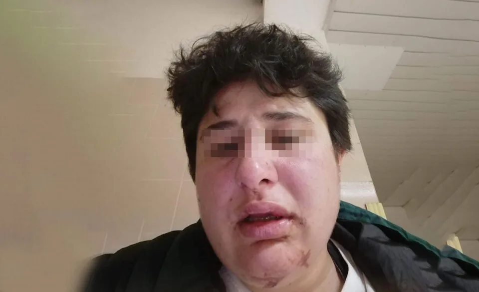 Read more about the article VIDEO Brutálny incident v Českom Krumlove: Známa influencerka a zápasník MMA surovo zbili dve ženy!