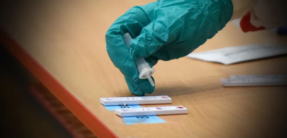 Read more about the article Na Slovensku pribudlo 4 036 prípadov nákazy koronavírusom a 16 obetí