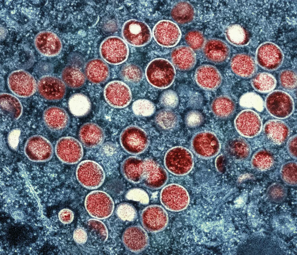 Read more about the article Ako by svet mohol nazývať opičie kiahne? Ak máte tip, zapojte sa do výzvy a možno uspejete