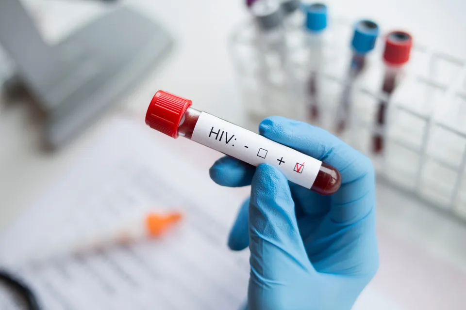 Read more about the article Kvôli koronavírusu sa ľudia menej testovali na HIV
