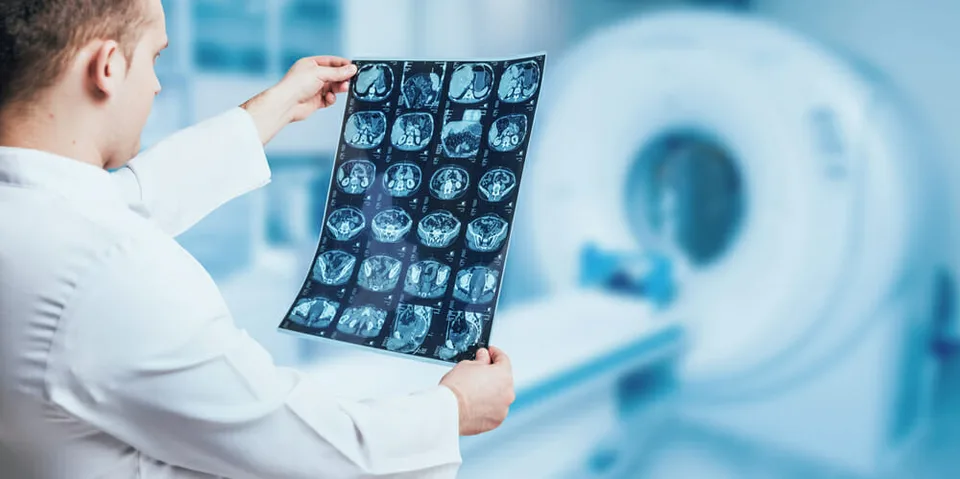 Read more about the article Pandémia má dosah na onkologické ochorenia, v prevencii treba pokračovať