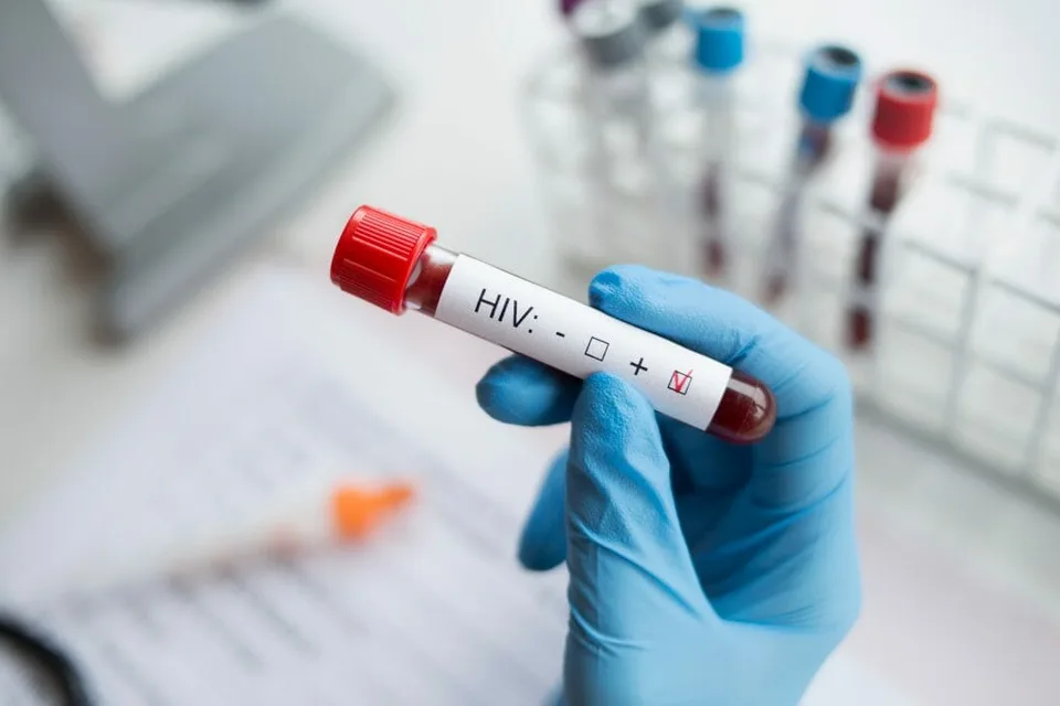 Read more about the article Testovaná vakcína proti HIV nepreukázala dostatočnú účinnosť