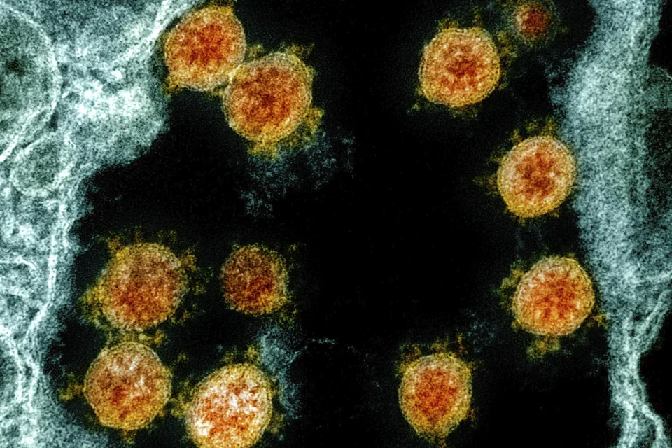 Read more about the article Korona valcuje svet. Nový denný rekord padol aj v rámci Európy