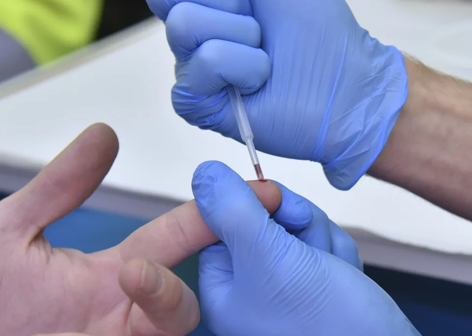 Read more about the article Ľudstvo má nový nástroj proti HIV: Vedci hovoria o zázraku, aktivisti o zlyhaní systému