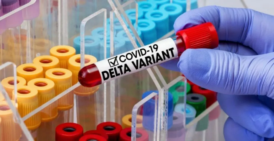 Read more about the article Čísla sa zlepšujú: Pribudlo 3391 prípadov nákazy a 41 obetí